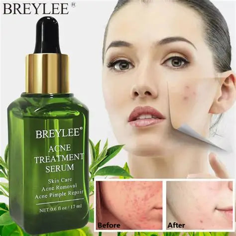 Face Serum