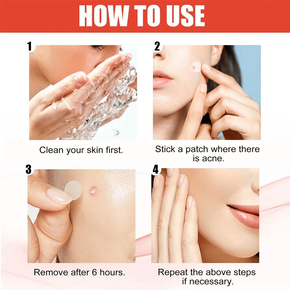 Pimple Patch Acne Dots Heart, Star, Flower & Round Shapes