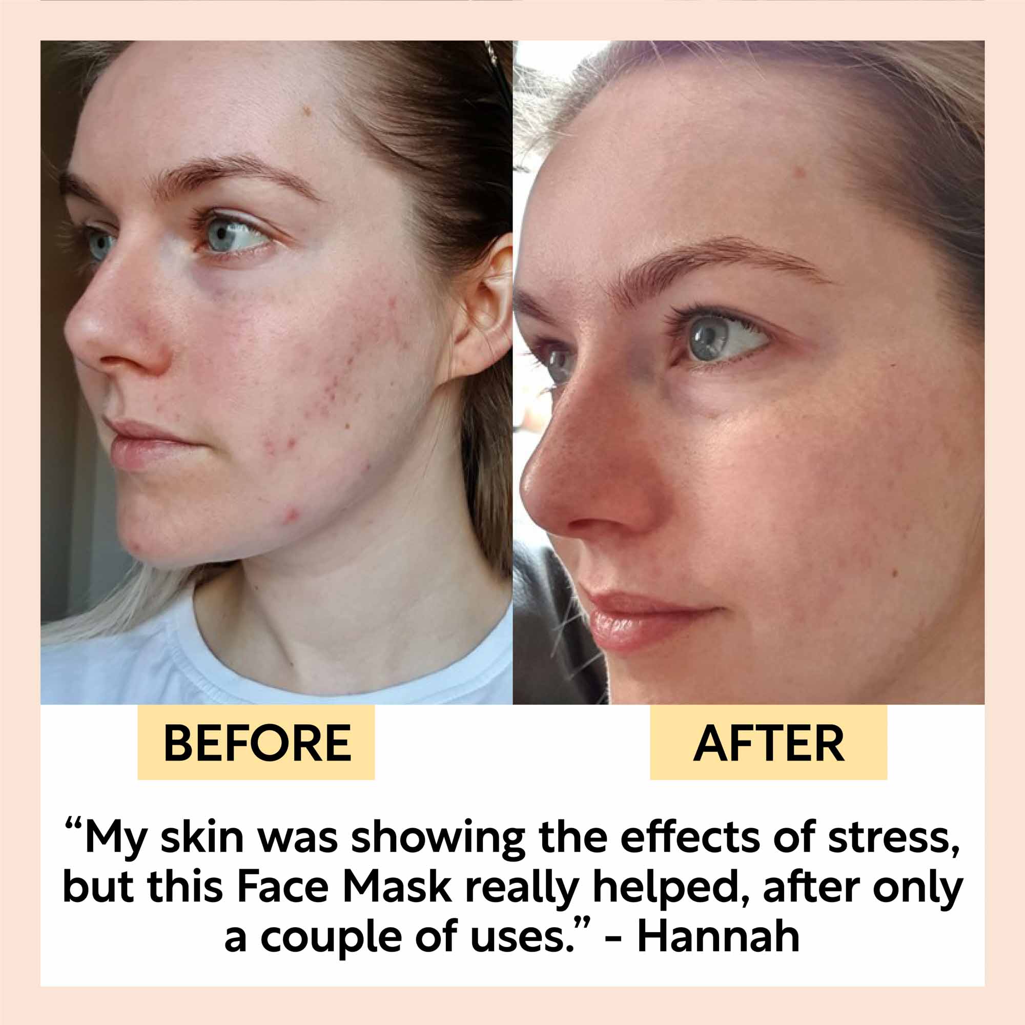 Pure Clay Kaolin Detox Face Mask