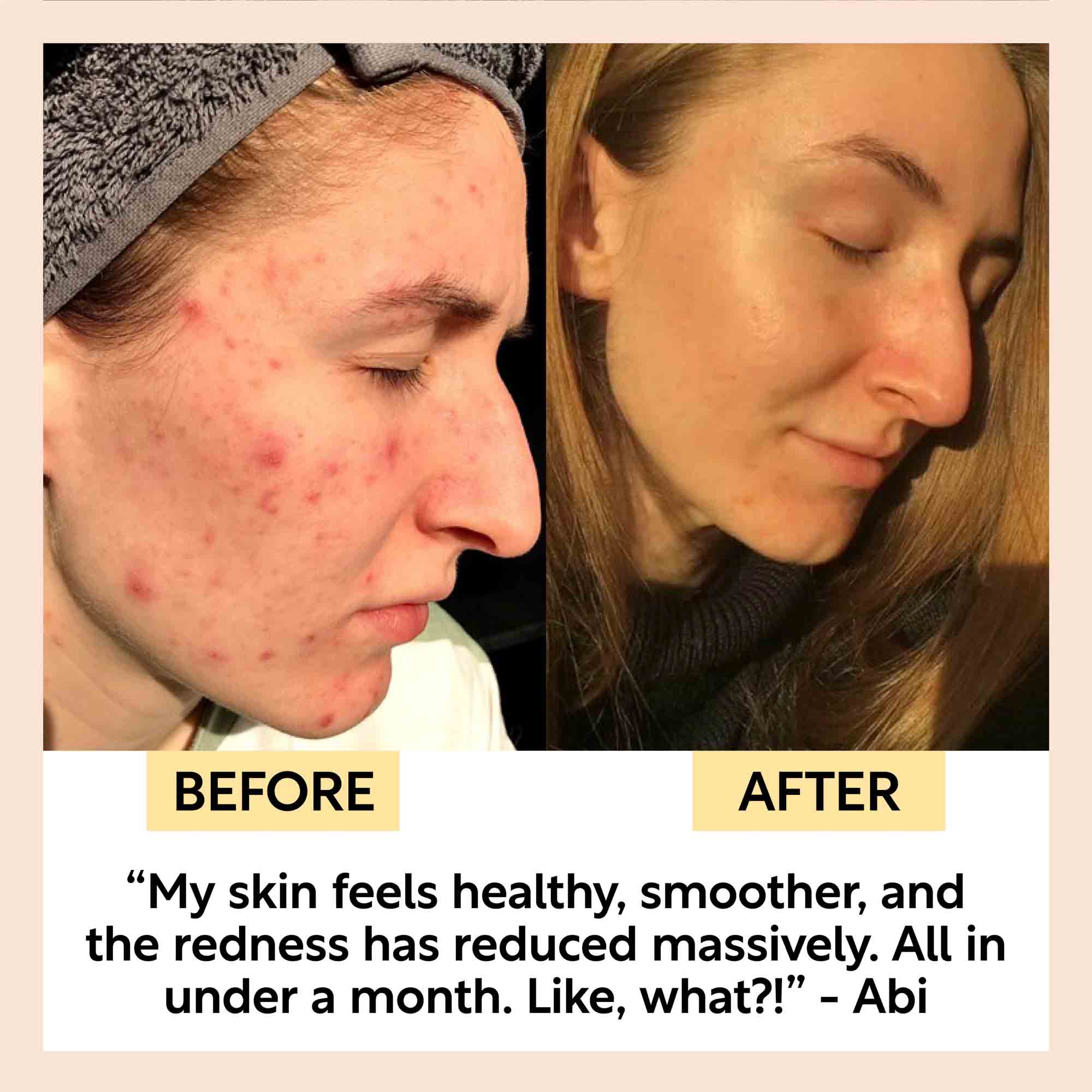 Pure Clay Kaolin Detox Face Mask
