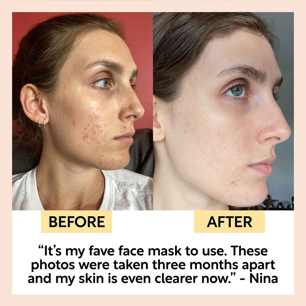 Pure Clay Kaolin Detox Face Mask