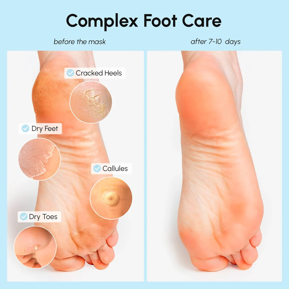 Sole Renewal Exfoliating & Hydrating Foot Mask