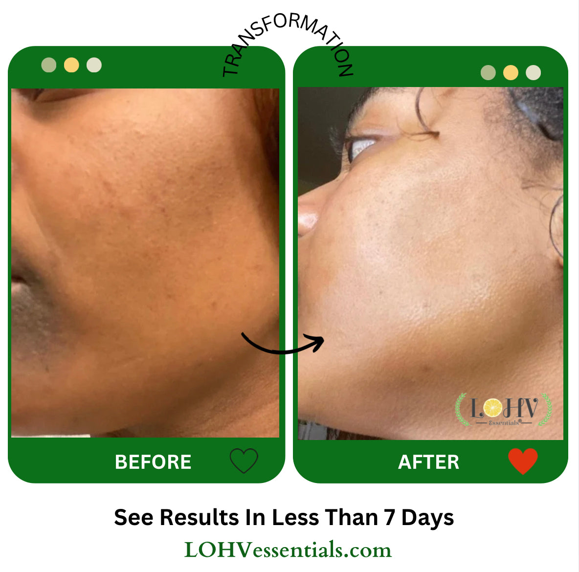 PREMIUM 100% VEGAN GLOW UP Toner Serum With Hyaluronic Acid + Niacinamide + Camellia Leaf + Vitamin E + Rose Water