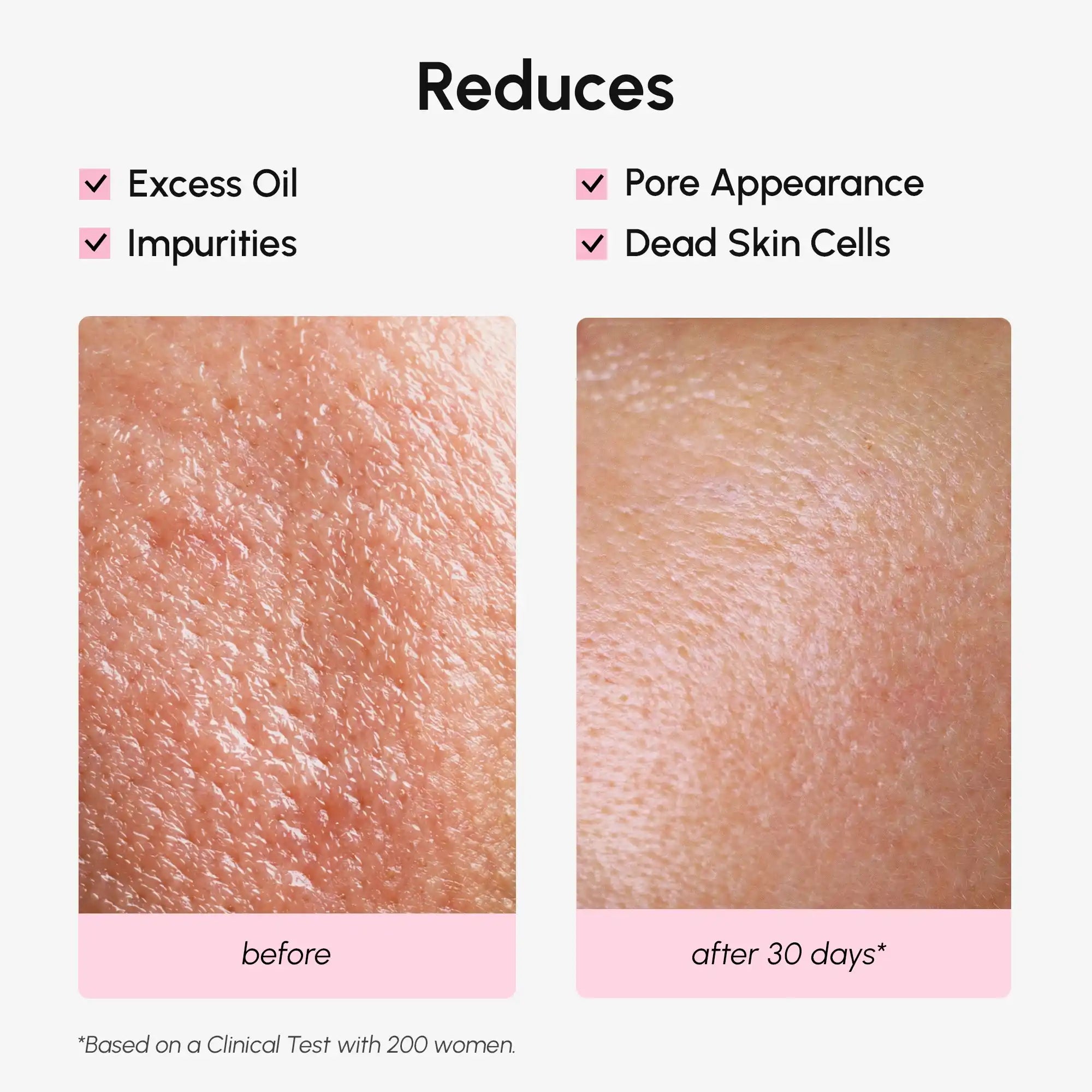 Pore Zen Hydrating Refining Toner