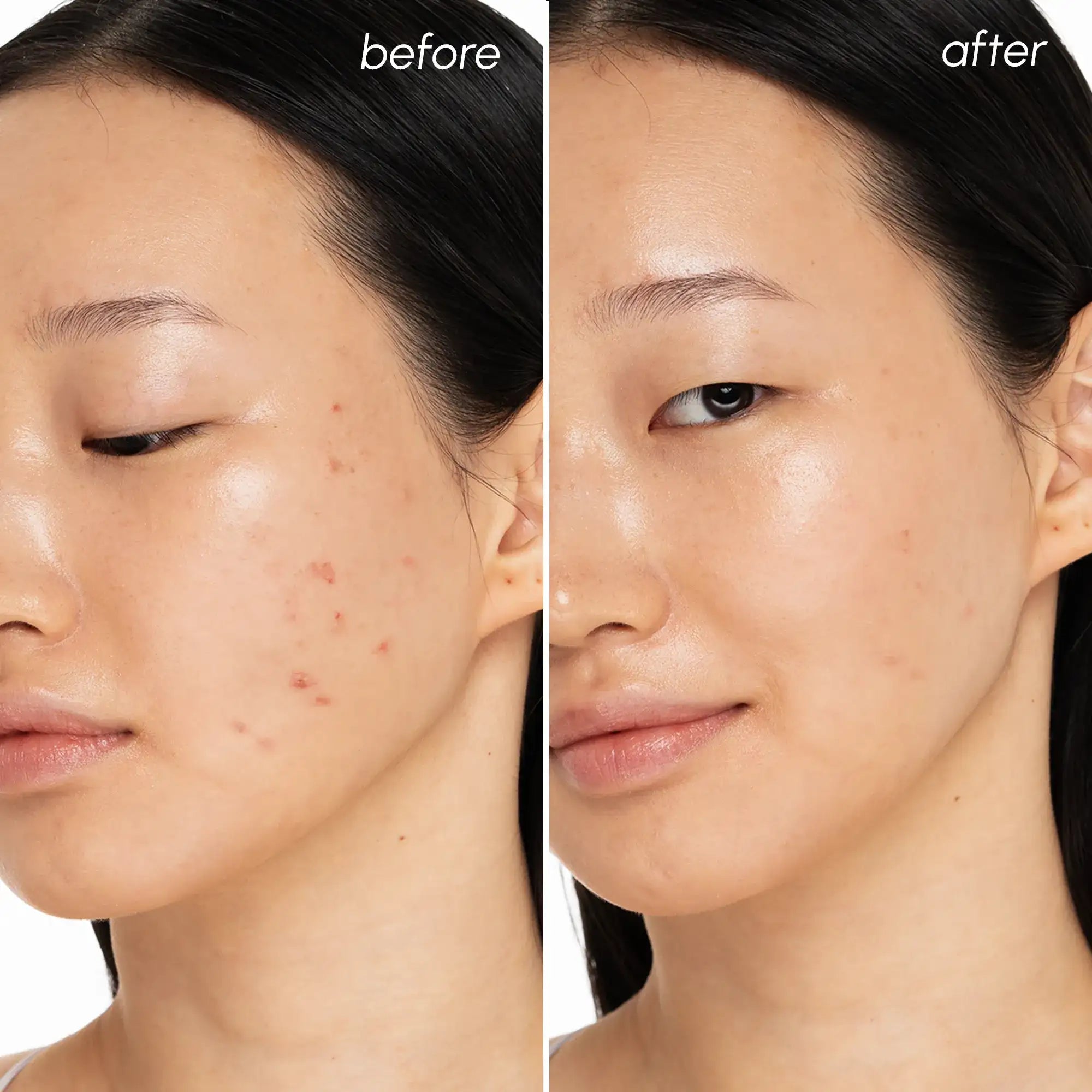 Pure Balance Witch Hazel Clearing Pads